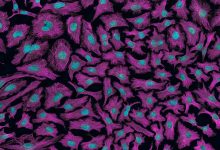 cils cerebral perception temps