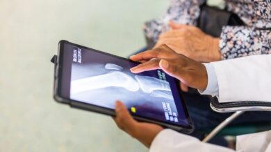 Osteoarthritis of the knee joint: artificial intelligence allows for ultra-early diagnosis